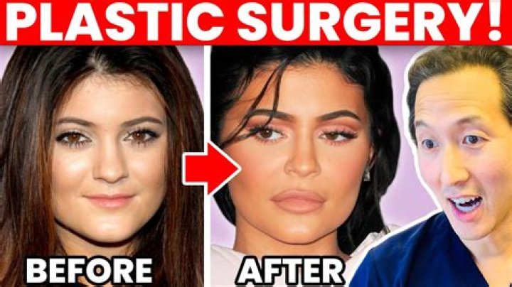 Kiaraakitty Plastic Surgery