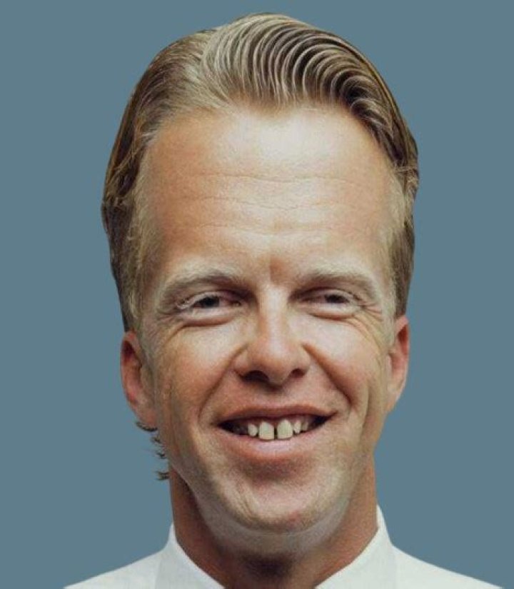 The Biggest Forehead In The World