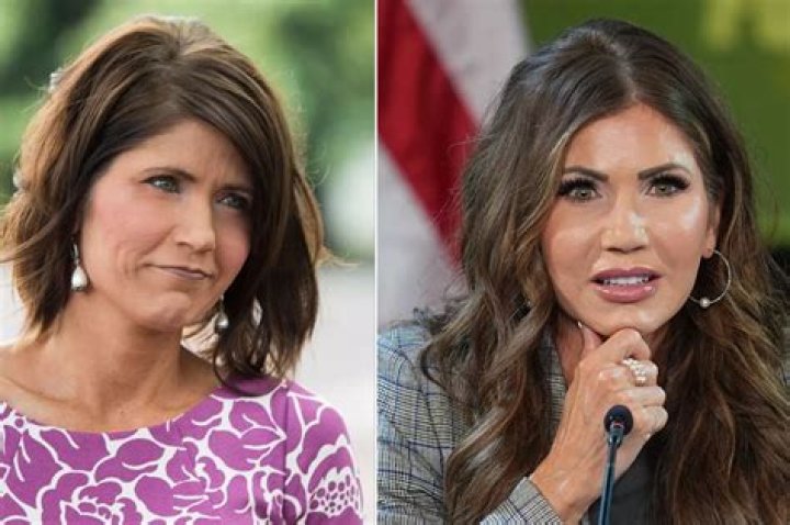 The Truth About Kristi Noem's Plastic Surgery: Before And After Photos